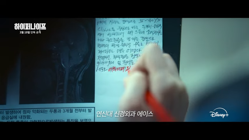 하이퍼 나이프 뜻과 출연진(박은빈, 설경구) 정보