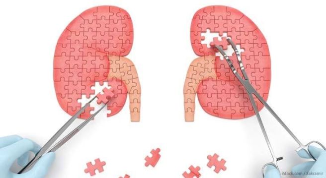 사구체신염 증상