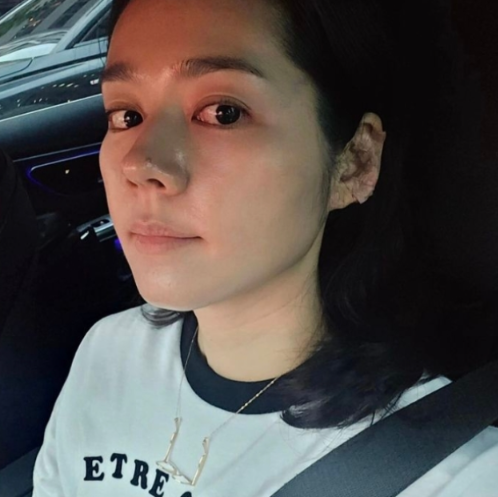 귀 혈자리 이혈 테라피 지압 패치 추천