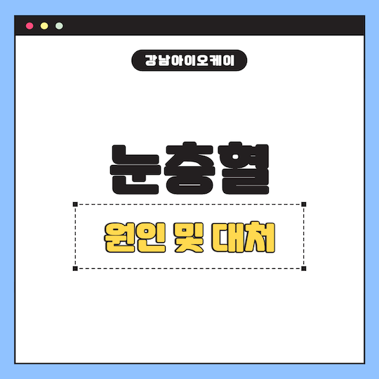 눈충혈-원인-대처