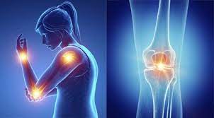 뼈엔 mbp 가격 후기 (3주 섭취)