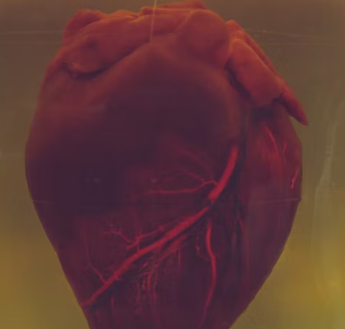 고지혈증 증상 원인 예방법 음식