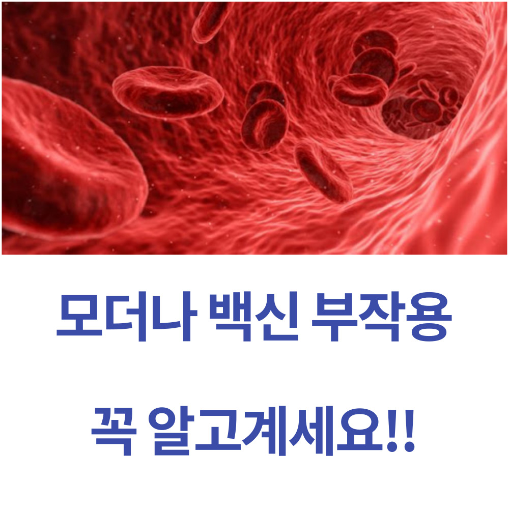 모더나백신부작용/