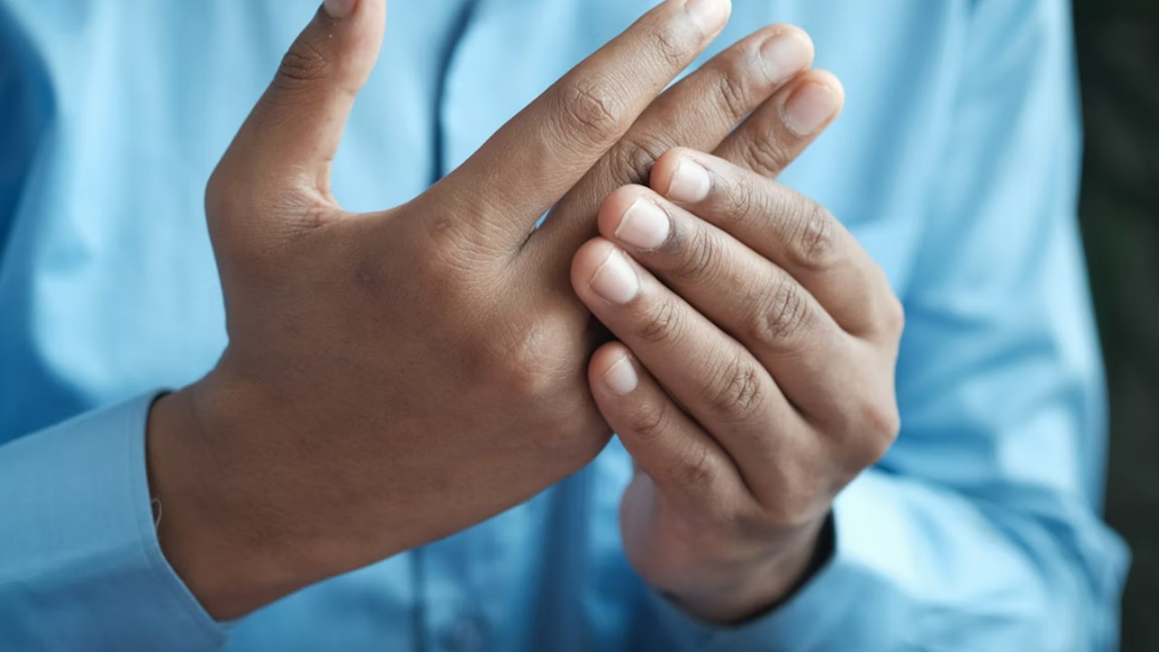 류마티스관절염 치료방향 약물치료,습관개선,유전자치료