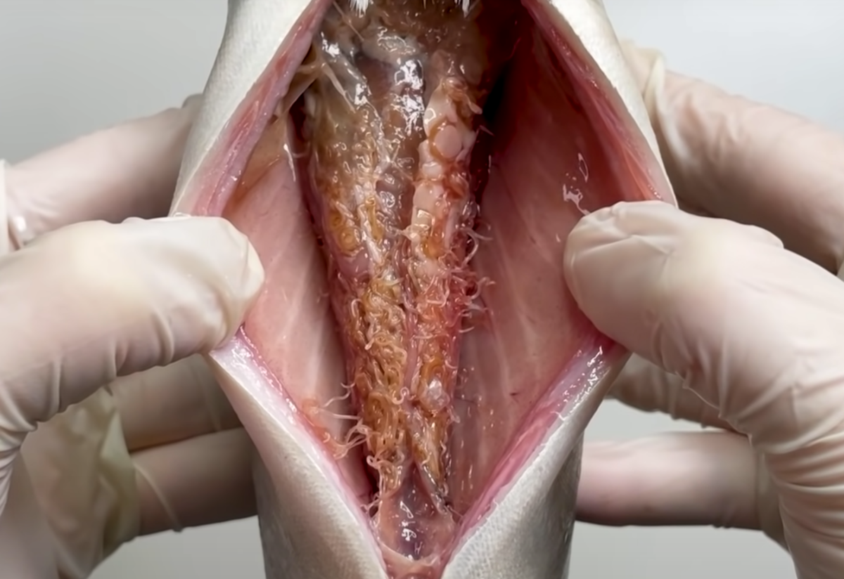 생선-안에-있는-고래회충