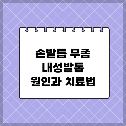 손발톱 무좀·내성발톱 원인과 치료법 썸네일