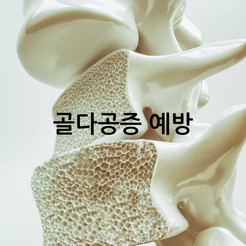 여성갱년기유산균 YT1