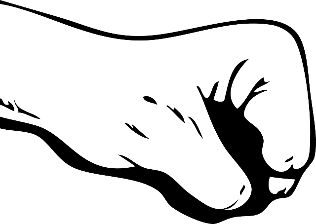 손목 수근관 증후군