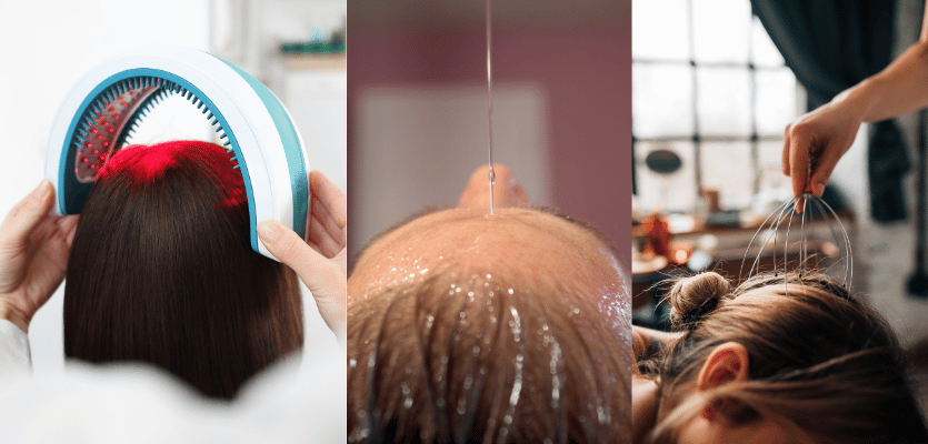 피부미용 - 헤드테라피(체계적인 두피관리, 모공, 모근)