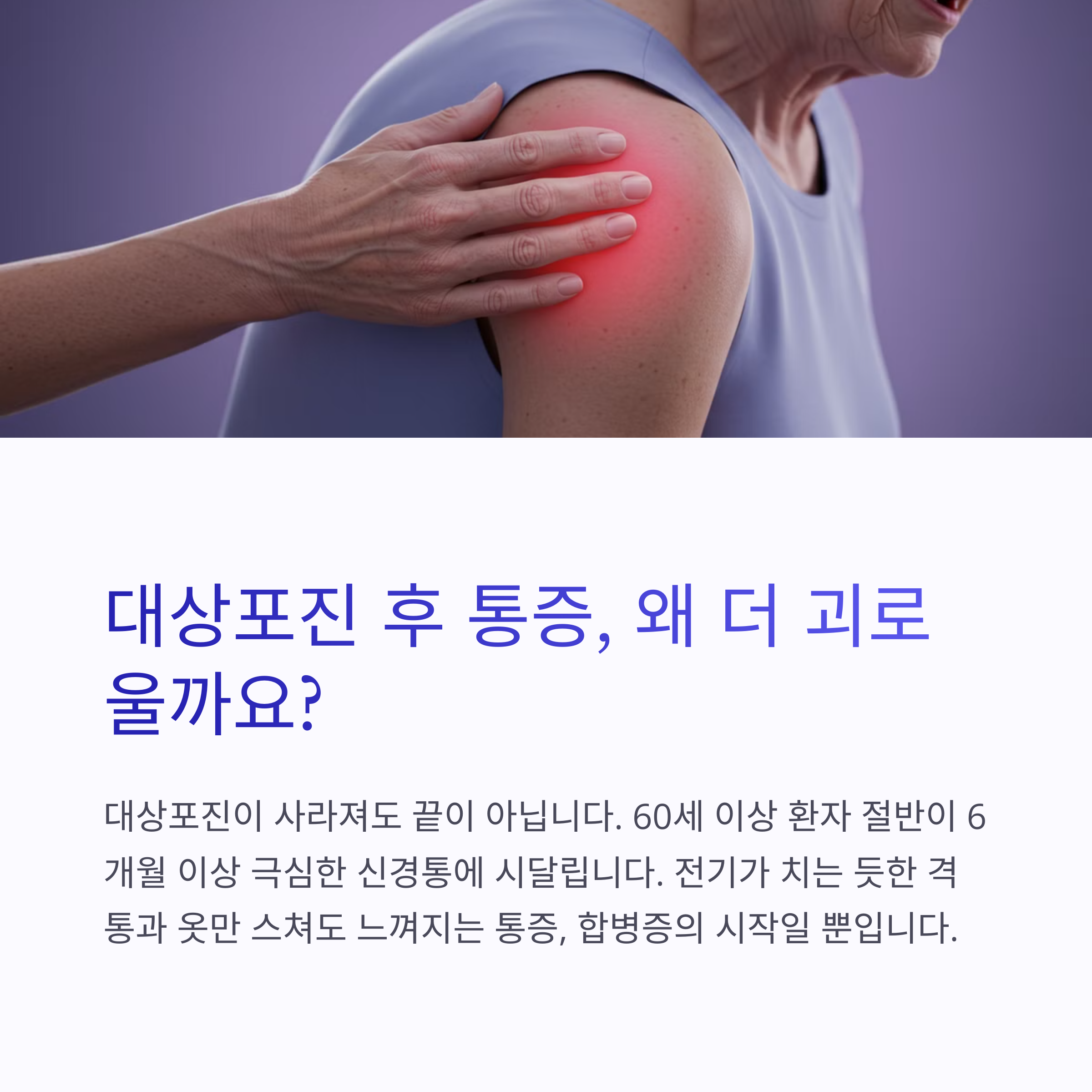 대상포진후합병증