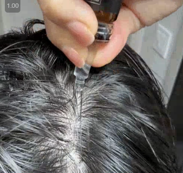 리맨틱 리바이브 탈모 앰플 리얼 내돈내산 효과