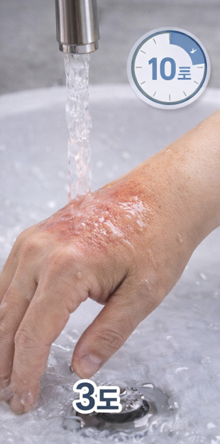 초기 10분, 올바른 응급처치 순서 관련 사진