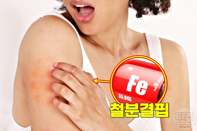 피부당김 얼굴당김 피부건조 가려움 원인 철분