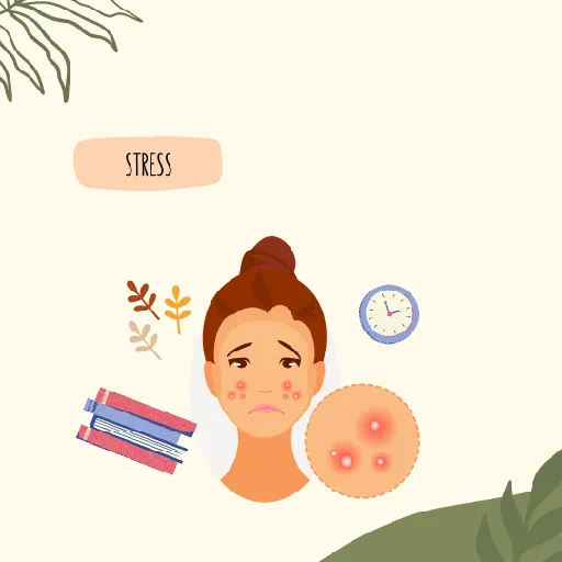 에스로반연고보관방법