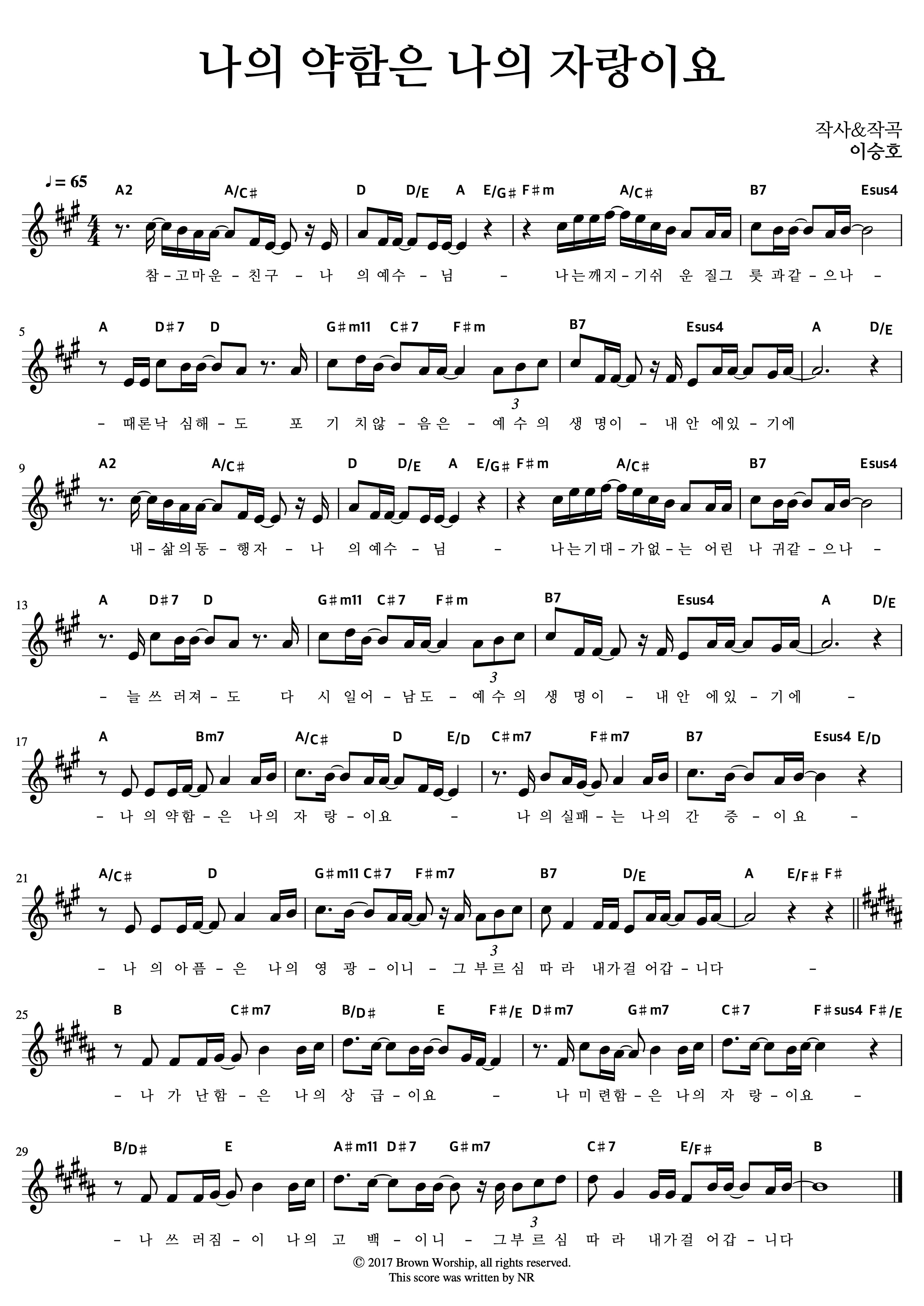 나의 약함은 나의 자랑이요