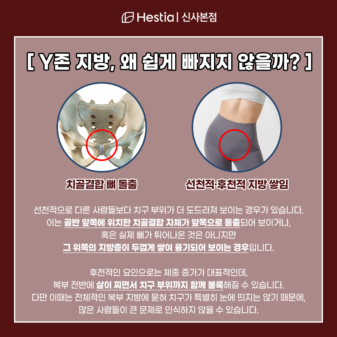 여자 치구, 왜 쉽게 빠지지 않는걸까?