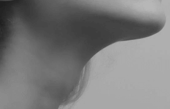 목주름 없애는 법