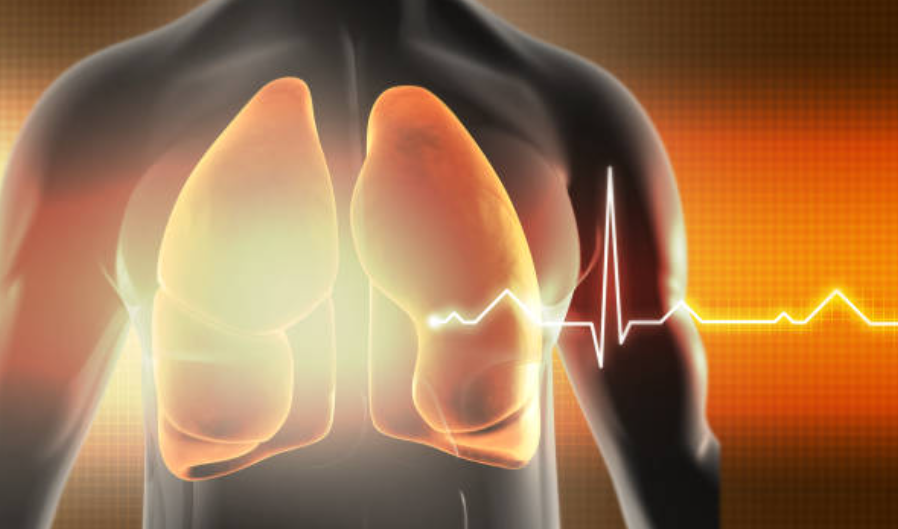 폐혈성 쇼크와 관련된 사진