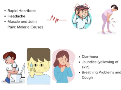 말라리아 증상 1