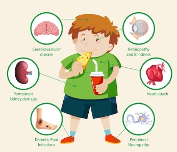 소아당뇨의 증상및 원인과 예방수칙 그리고 증상완화 계획 연구