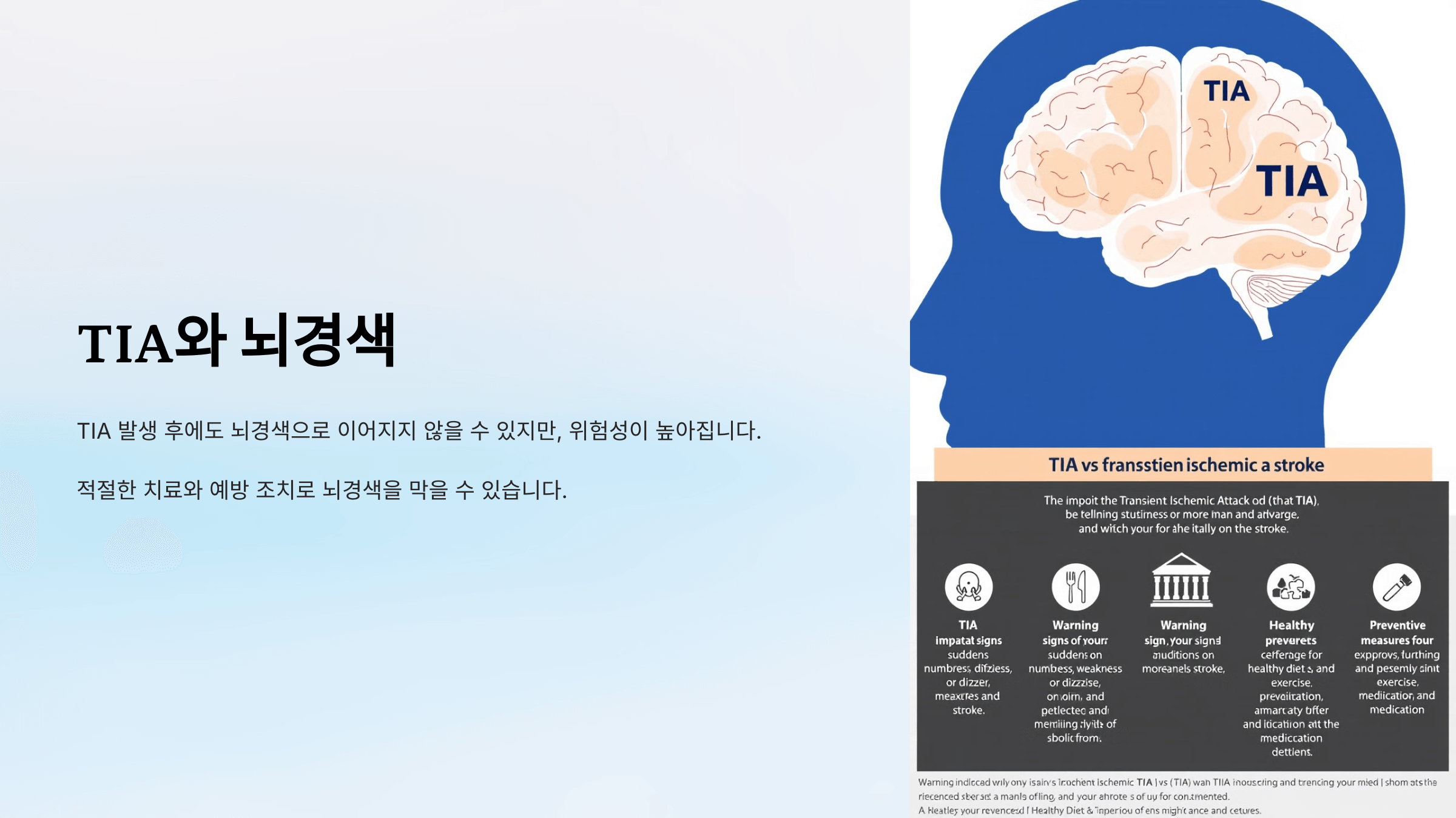 뇌경색과 관련된 사진입니다.