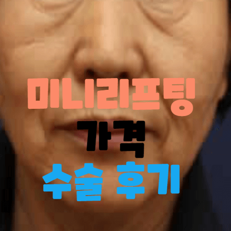 주름과 피부처짐이 심해서 미니리프팅이 필요한 여성의 모습