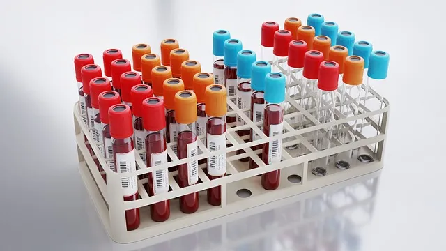 알부민 수치 알부민정상범위 알부민 많은 음식