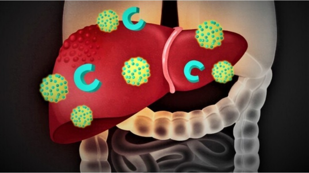 간수치가-올라가는-이유
