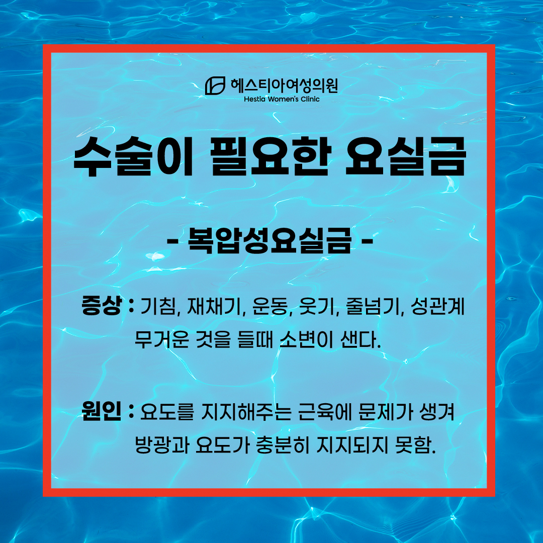요실금수술 필요한 요실금 : 복압성 요실금
