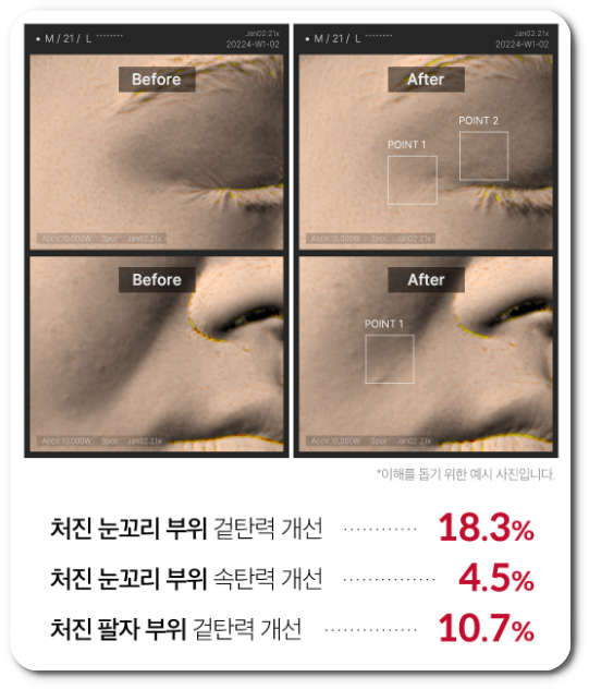 에이지알 더마 EMS 샷의 효과
