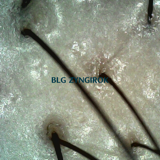 탈모 극복 프로젝트 - 정수리와 이마 사이 두피 모습이다.