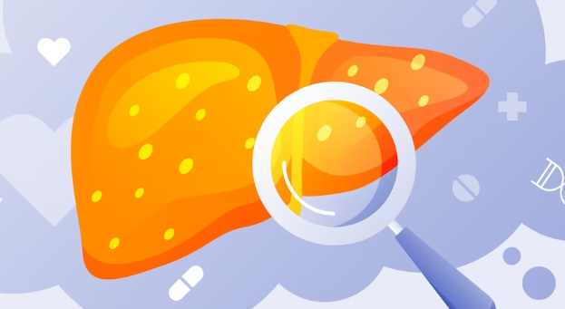 지방간 질환은 어떻게 진단되나요?