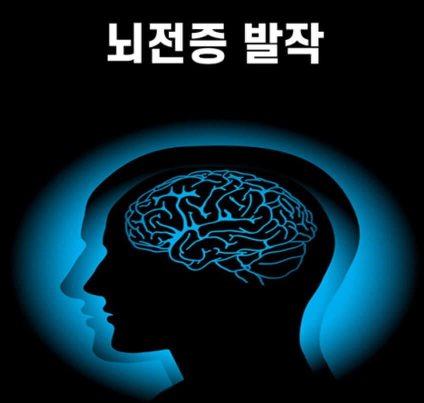 뇌전증 발작
