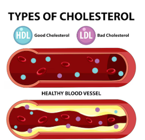 콜레스테롤이란? 콜레스테롤 수치의 중요성