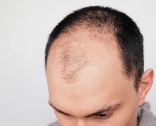 그래비티 샴푸10