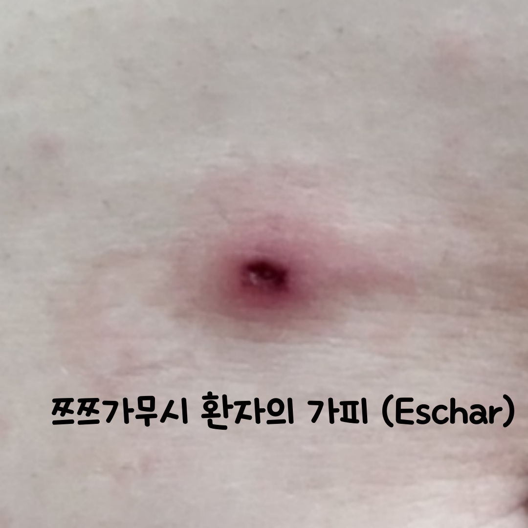 가피