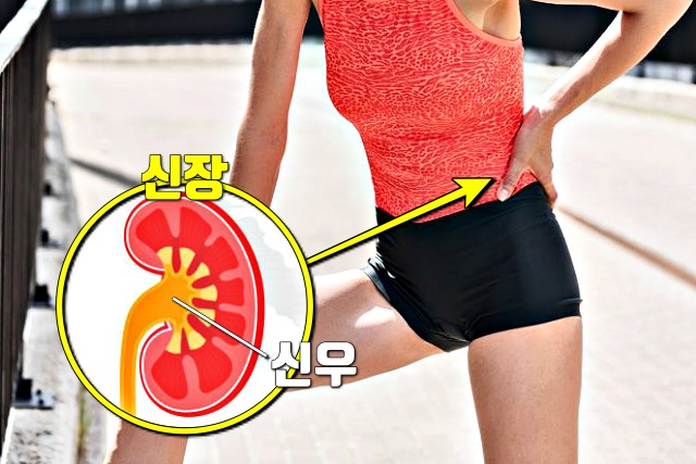 왼쪽 옆구리 통증 의심되는병 신우신염 증상, 건강 팁줌 매일꿀정보