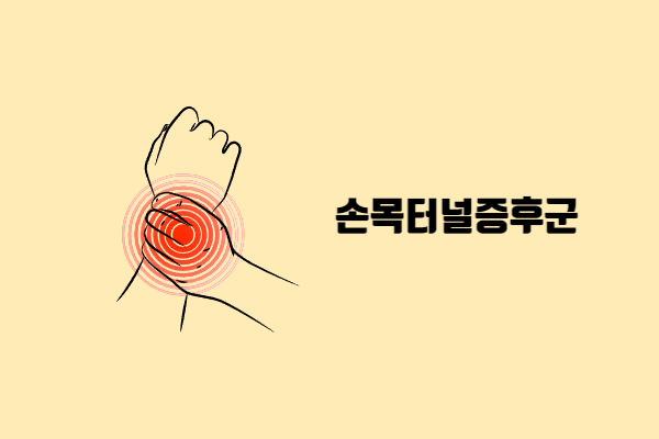 손바닥이-반대편-팔목을-잡고-있는-모습