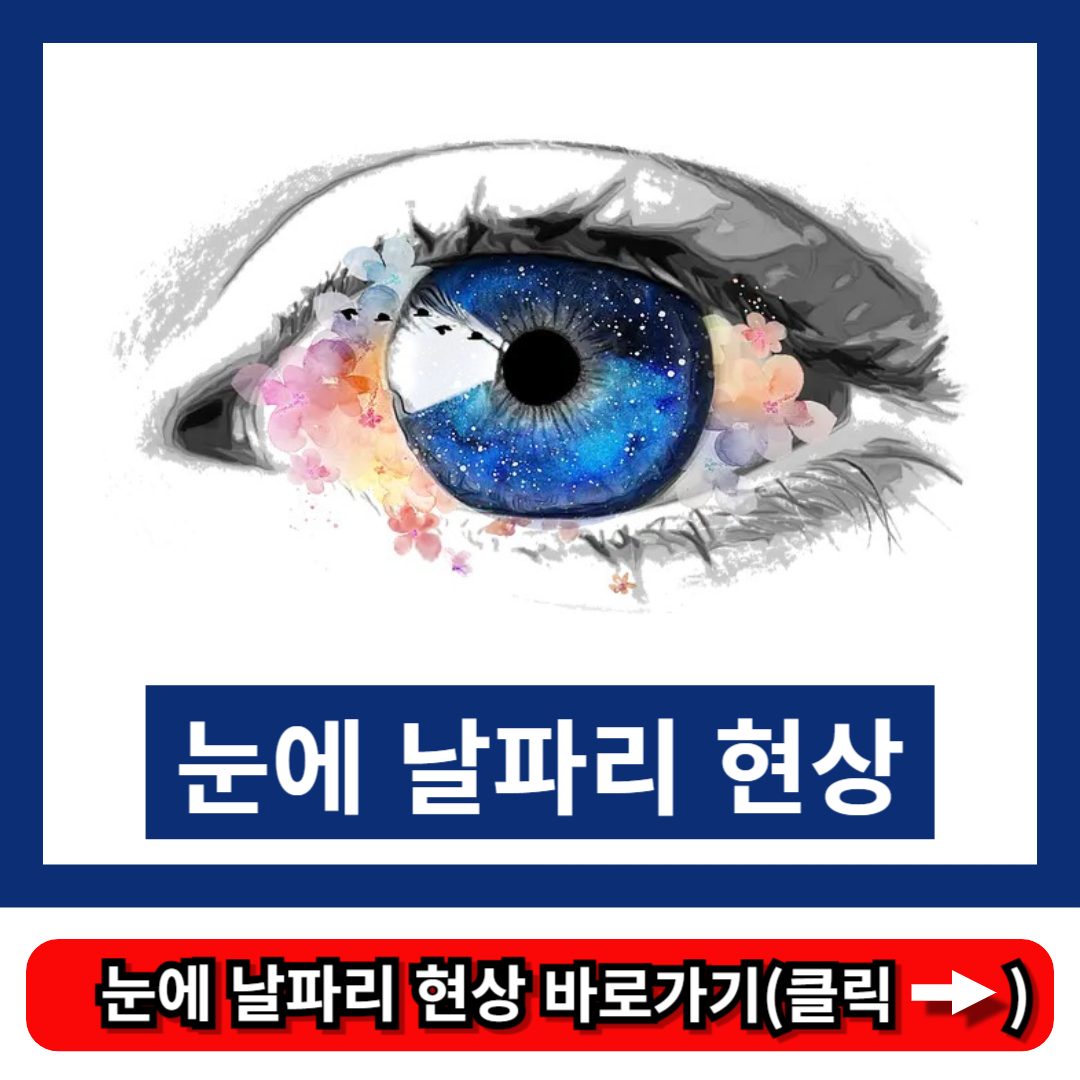 눈에 날파리 현상