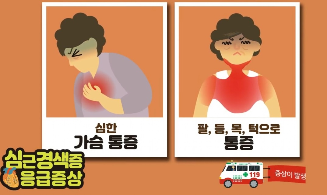 심근경색-응급증상