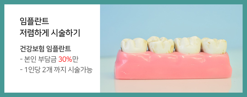 임플란트