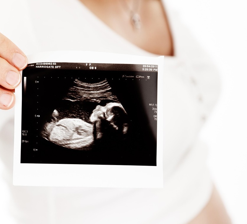 초음파 사진을 들고있는 임산부