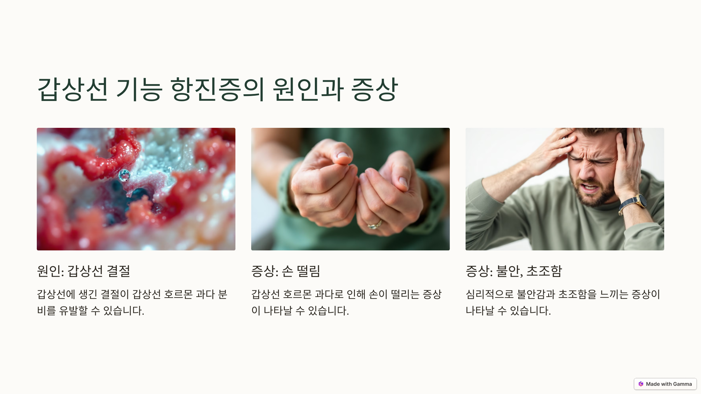 갑상선 기능항진증