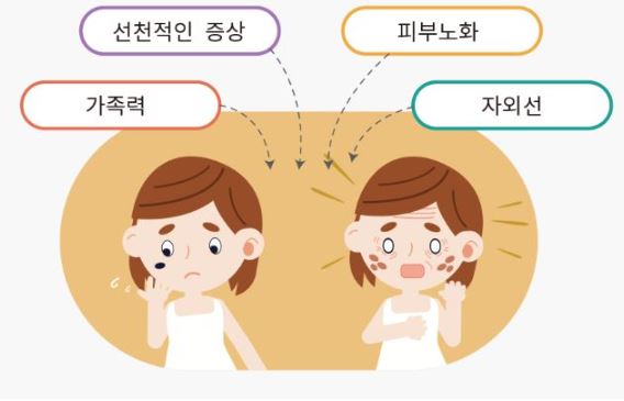 검버섯