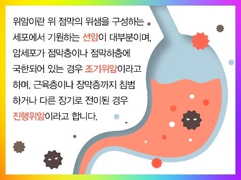 위암 이미지
