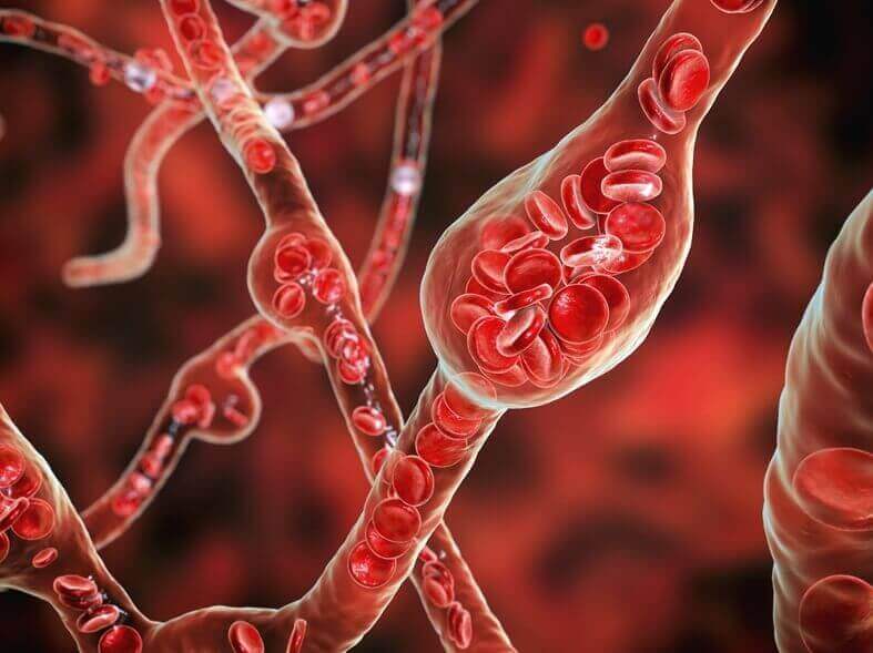 콘드로이친 1200mg