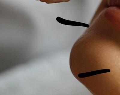 얼굴이 가려운 이유