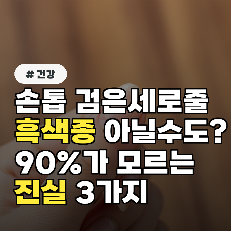 손톱 검은세로줄, 흑색종 아닌 경우도 90%가 모르는 진실 3가지