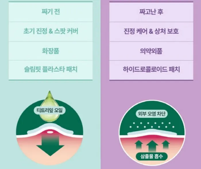 여드름 패치 사용 방법 이미지
