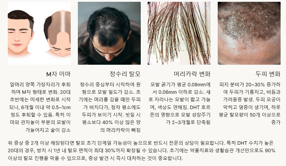 20대 탈모 증상